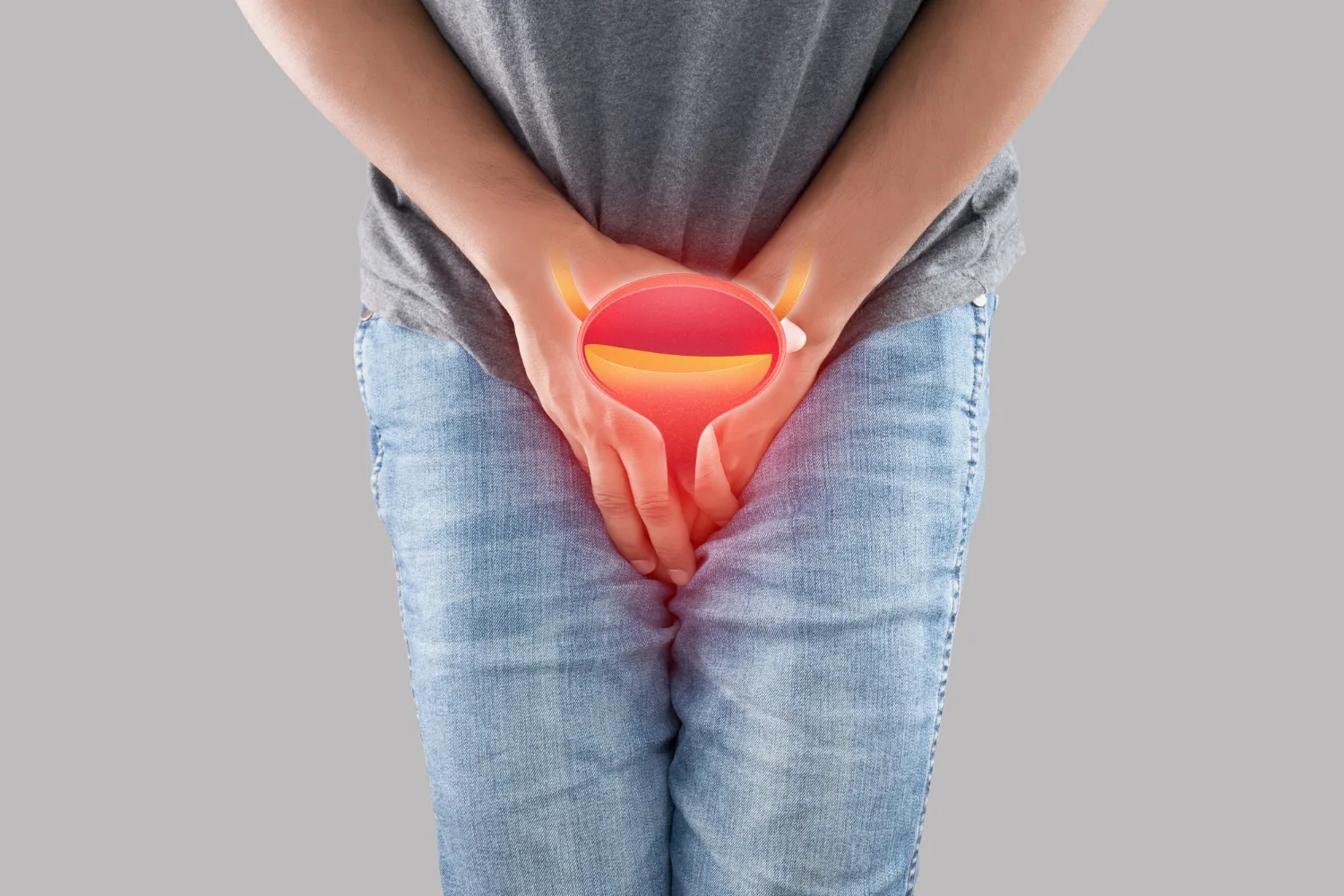 Cáncer de vejiga